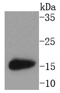 MAP1LC3A Rabbit mAb