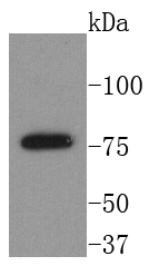 BTK Rabbit mAb