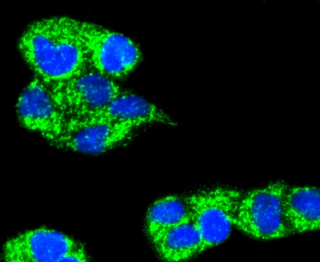 TNFAIP3 Rabbit mAb