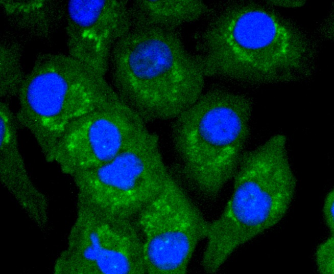 TNFAIP3 Rabbit mAb