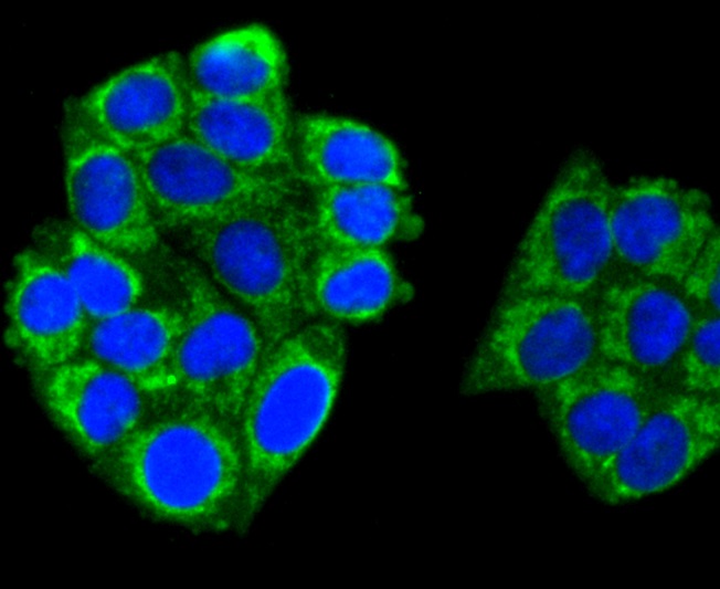 TNFAIP3 Rabbit mAb