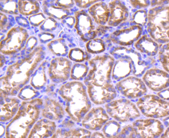 TNFAIP3 Rabbit mAb