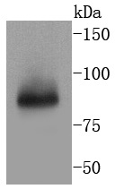 TNFAIP3 Rabbit mAb