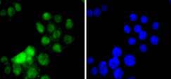 HNF-4-alpha Rabbit mAb