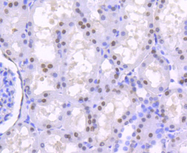 HNF-4-alpha Rabbit mAb