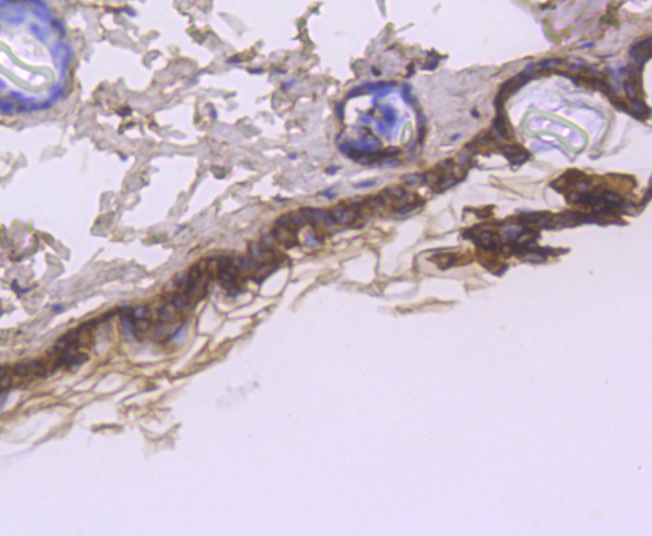 Cytokeratin 1 Rabbit mAb