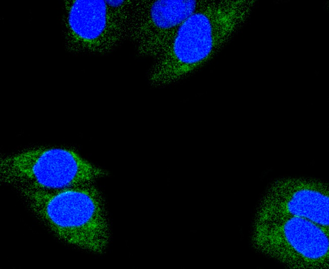 Glutaminase Rabbit mAb