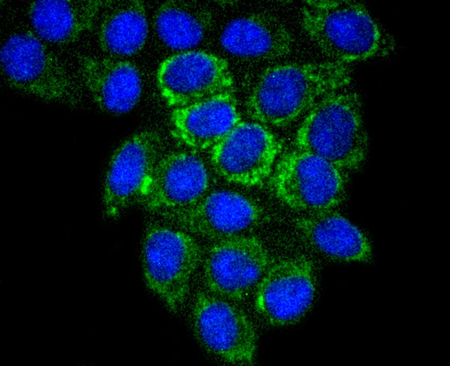 Glutaminase Rabbit mAb