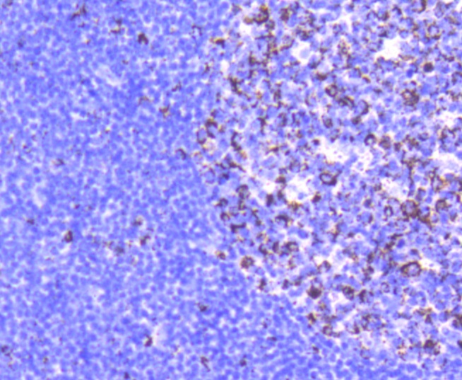 Glutaminase Rabbit mAb