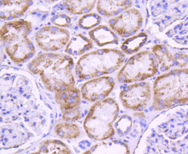 Glutaminase Rabbit mAb