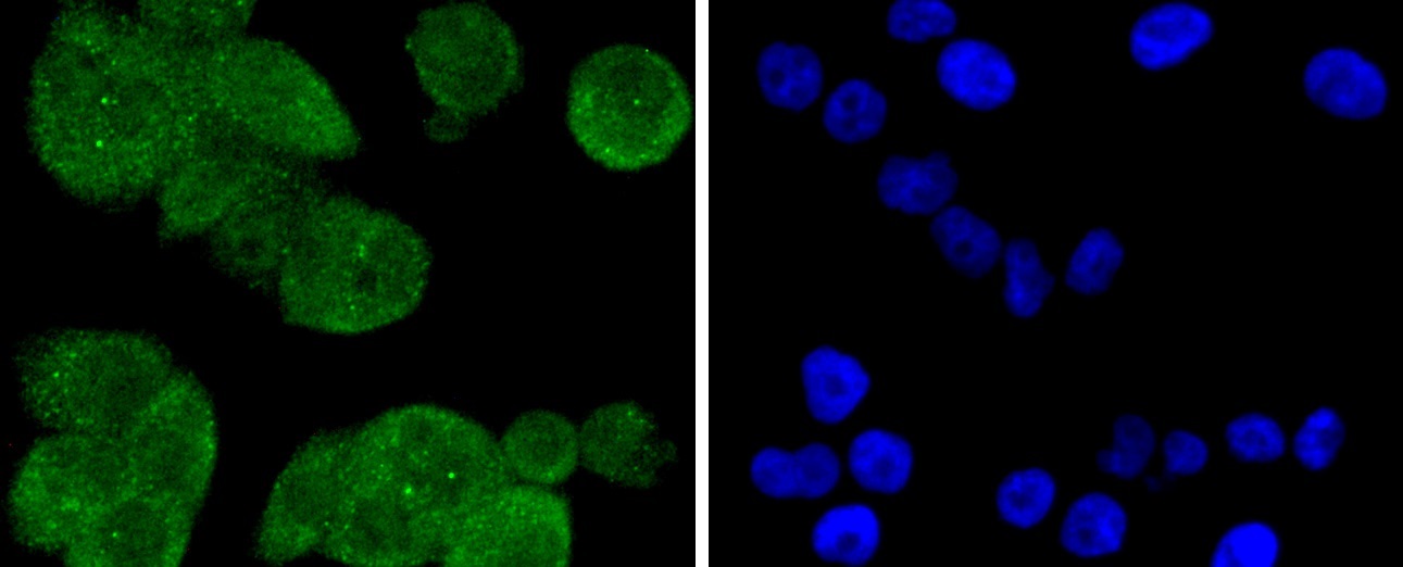 PP2A alpha + beta Rabbit mAb