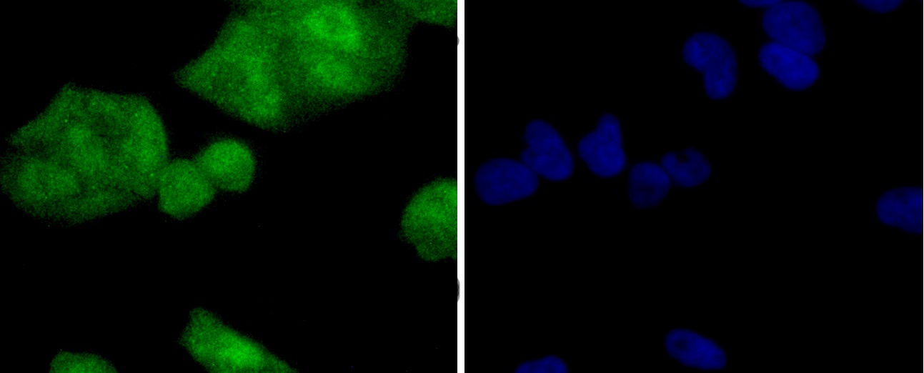 PP2A alpha + beta Rabbit mAb