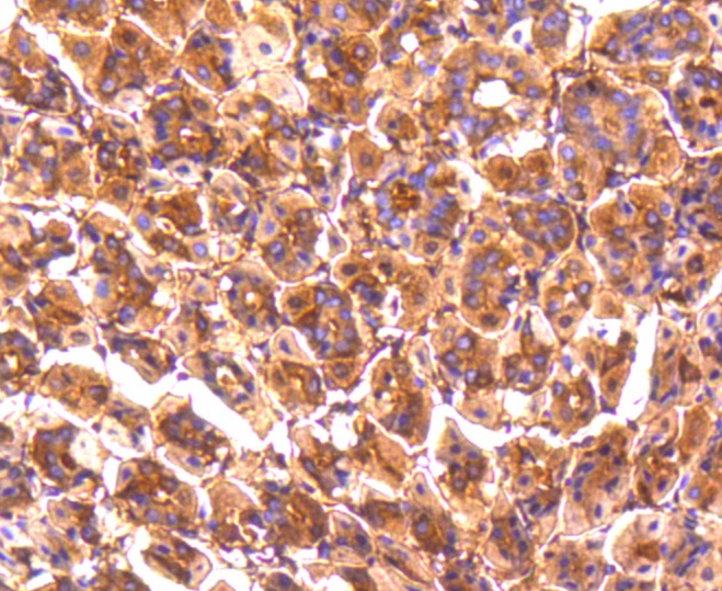 PP2A alpha + beta Rabbit mAb