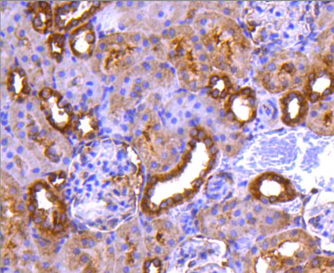 PP2A alpha + beta Rabbit mAb