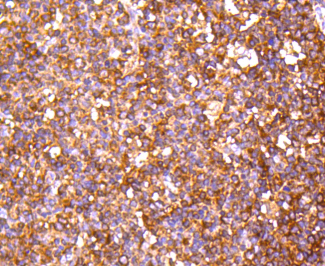 PP2A alpha + beta Rabbit mAb