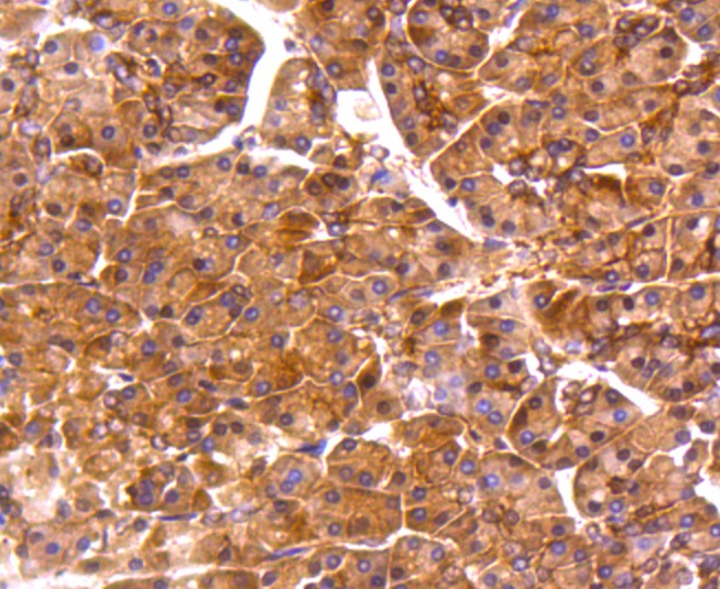 PP2A alpha + beta Rabbit mAb