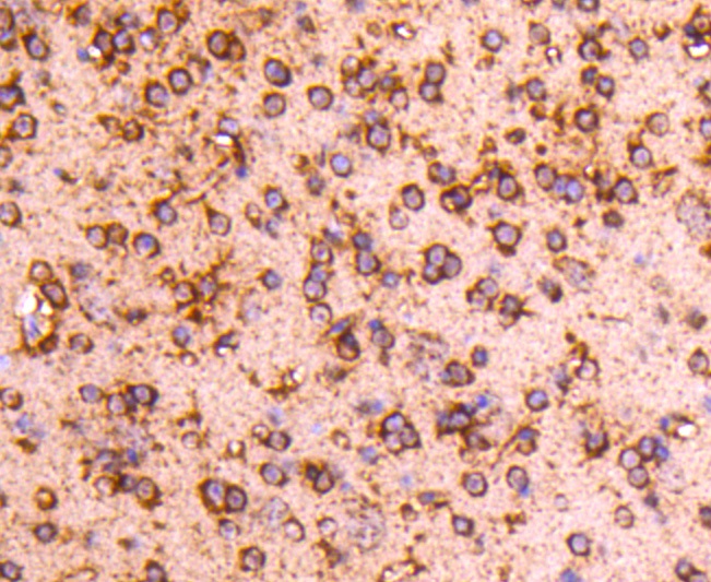 PP2A alpha + beta Rabbit mAb