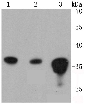 PP2A alpha + beta Rabbit mAb