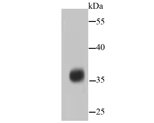 PP2A alpha + beta Rabbit mAb