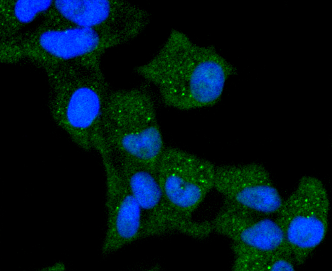 Cytokeratin 13 Rabbit mAb