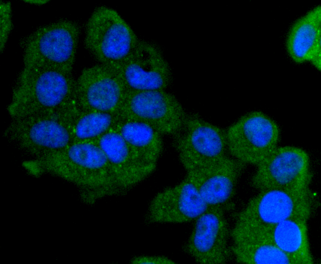 Cytokeratin 13 Rabbit mAb