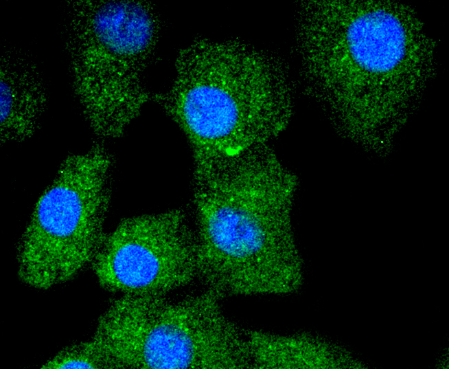 Cytokeratin 13 Rabbit mAb