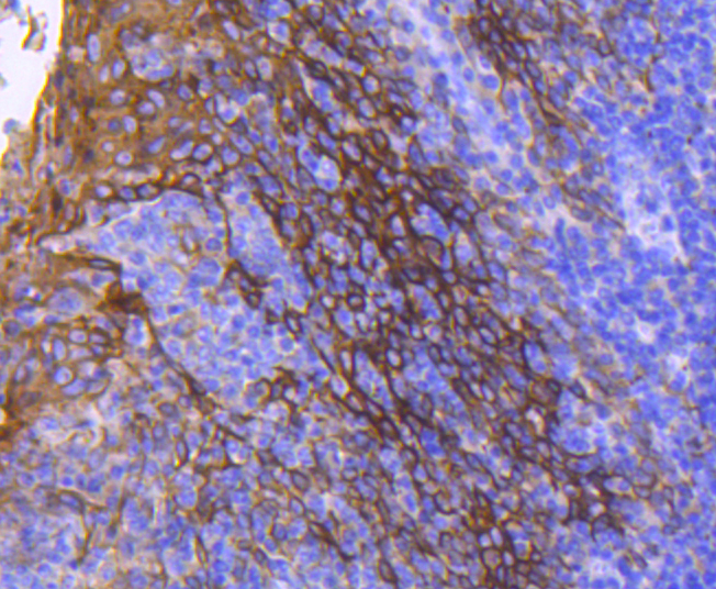 Cytokeratin 13 Rabbit mAb