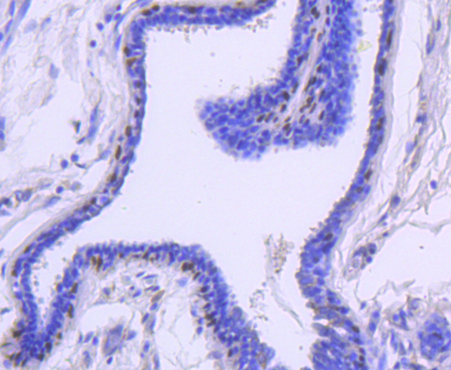 Cytokeratin 13 Rabbit mAb