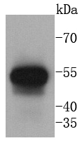 Cytokeratin 13 Rabbit mAb