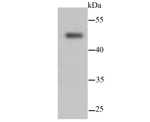 Cytokeratin 13 Rabbit mAb