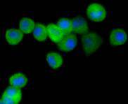 PPP1R1A Rabbit mAb