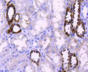 PPP1R1A Rabbit mAb