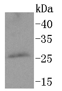 PPP1R1A Rabbit mAb