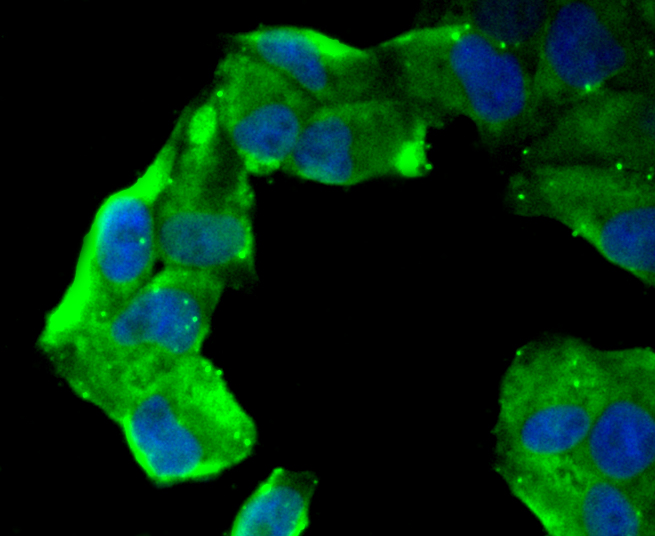 CD13 Rabbit mAb