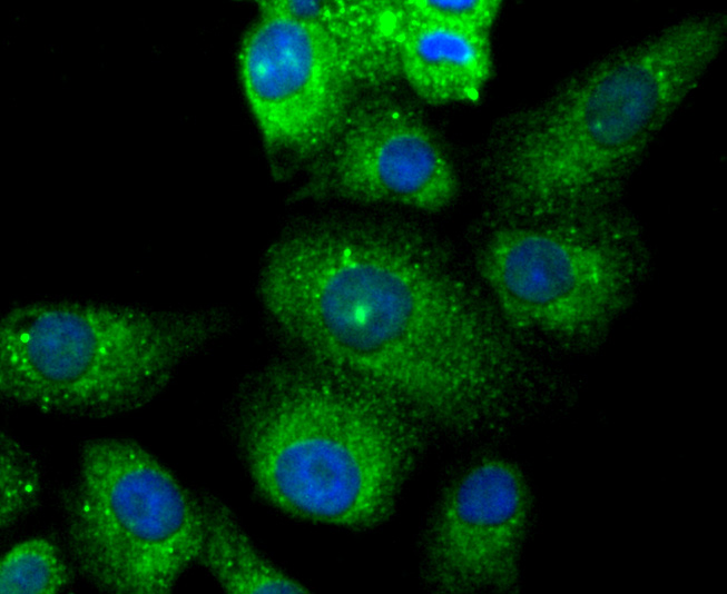 TMS1 Rabbit mAb