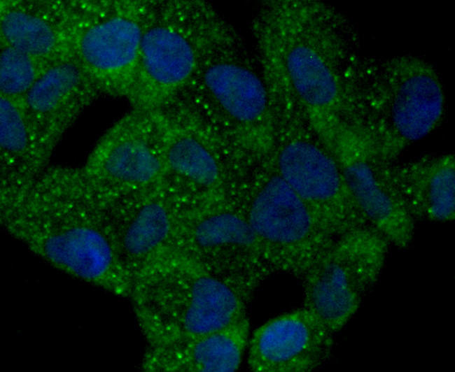 TMS1 Rabbit mAb