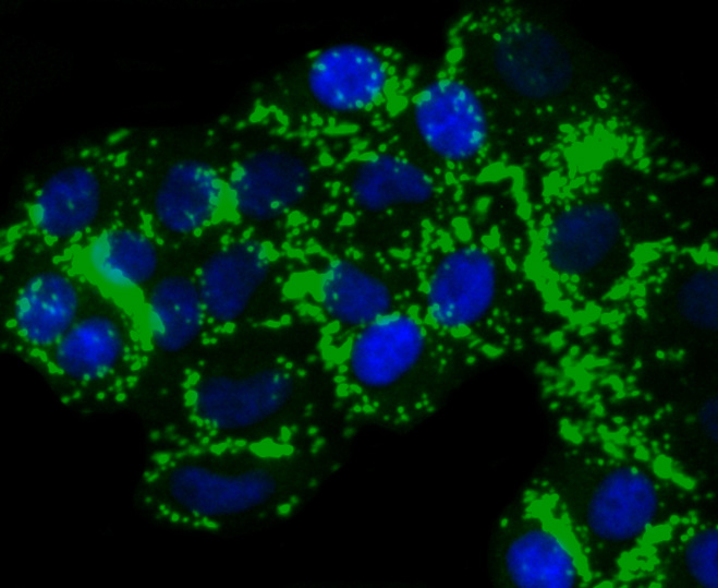 TMS1 Rabbit mAb