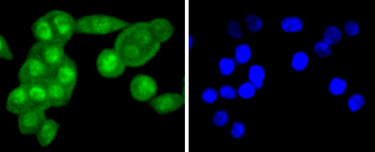 FANCD2 Rabbit mAb