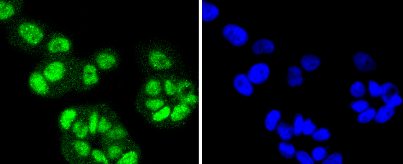 FANCD2 Rabbit mAb