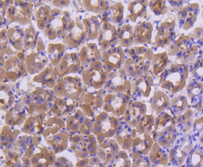 FANCD2 Rabbit mAb