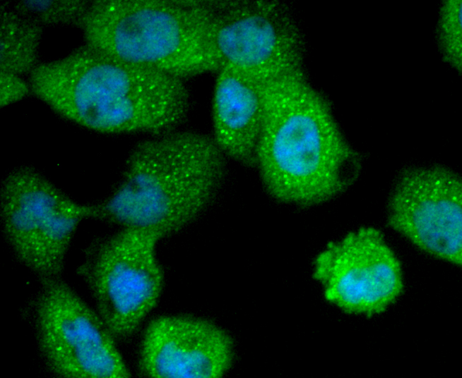 Cytokeratin 4 Rabbit mAb