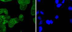 Cytokeratin 4 Rabbit mAb