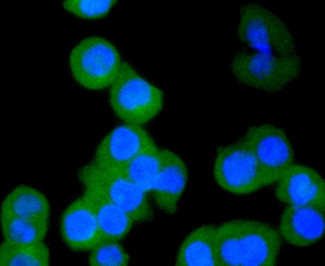 Cytokeratin 4 Rabbit mAb