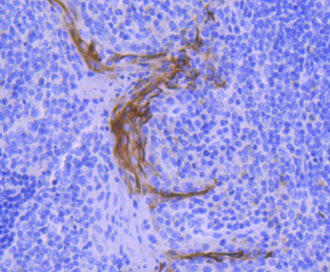 Cytokeratin 4 Rabbit mAb