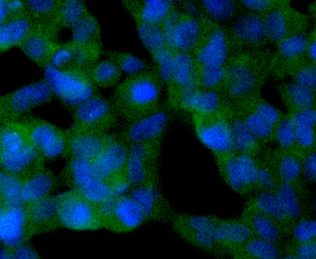 SIRT2 Rabbit mAb