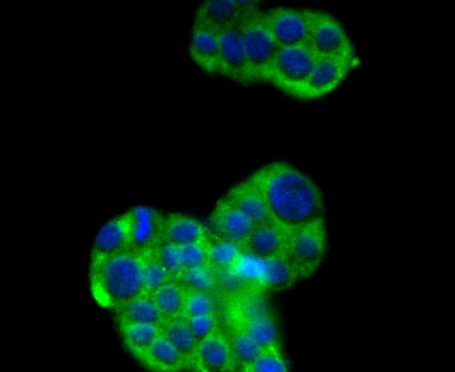 SIRT2 Rabbit mAb