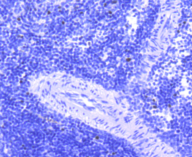 FosB Rabbit mAb