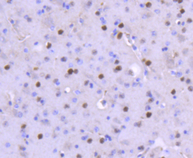 FosB Rabbit mAb