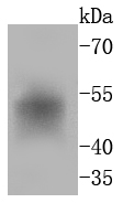 FosB Rabbit mAb