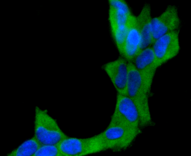 CD10 Rabbit mAb